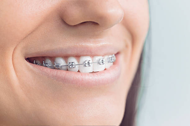 Best Traditional Braces  in Rossville, IN